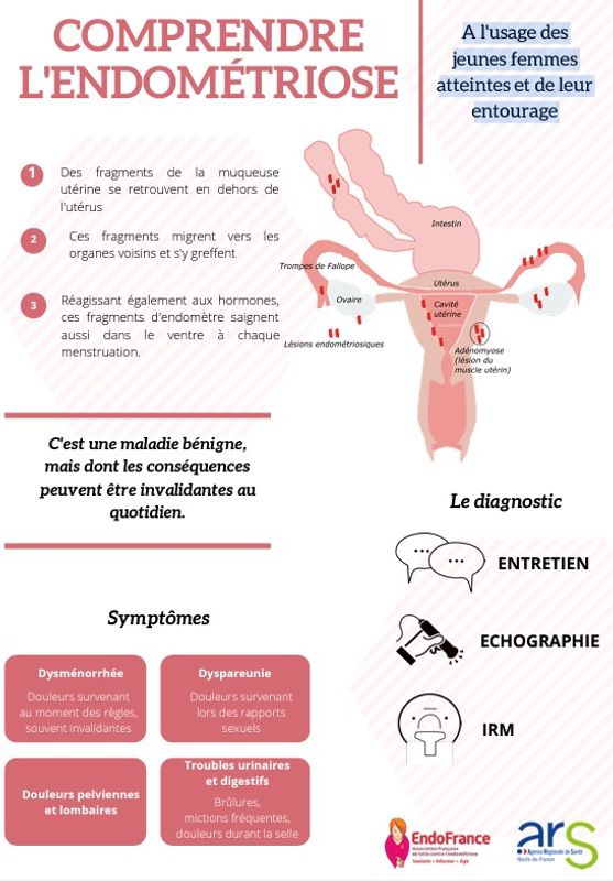Comprendre l'endométriose