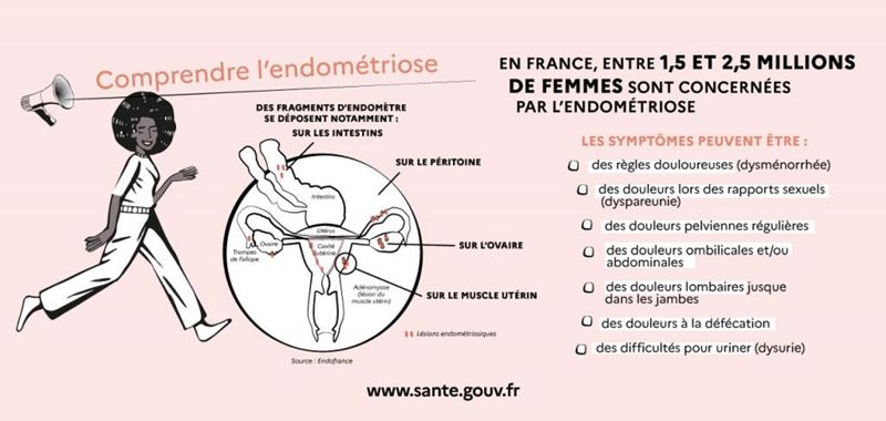 Infographie comprendre l’endométriose et ses symptômes