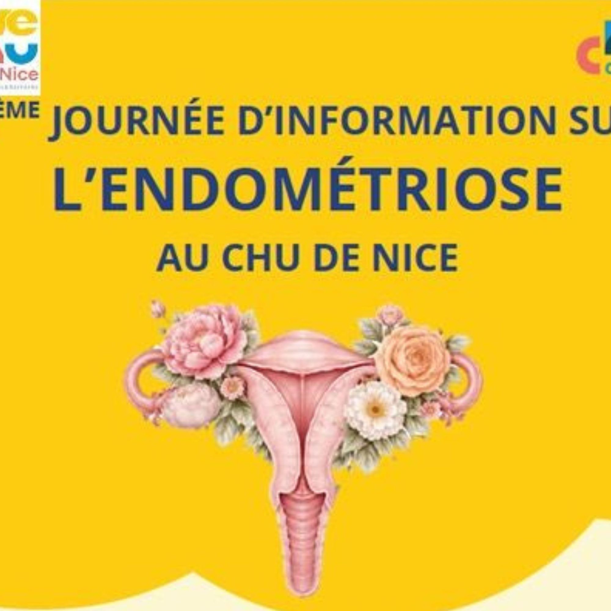 Mars JAUNE : sensibiliser à l’endométriose